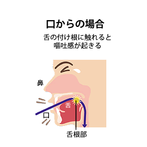 口からの場合