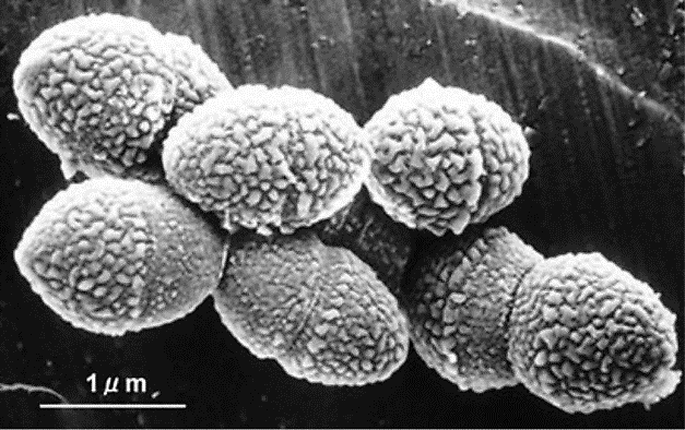 『肺炎球菌ワクチン』について